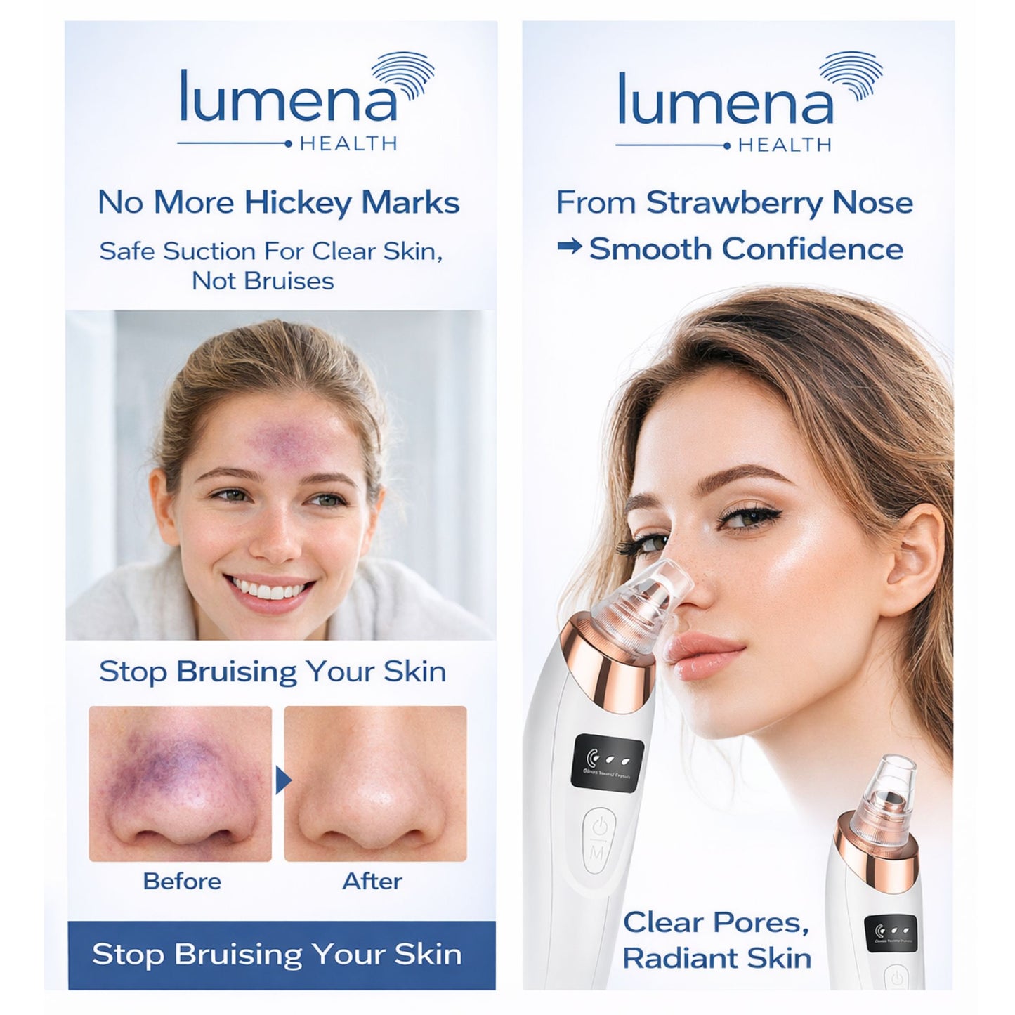 Lumera PoreLuxe™